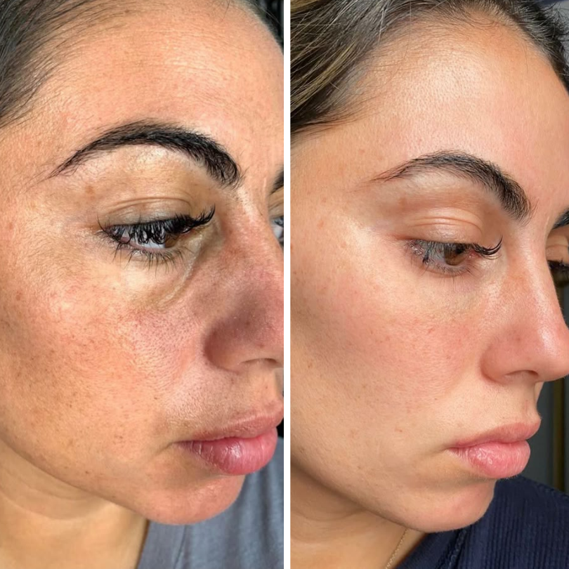 Biancat® LiftRenew All-in-One Augenpflege-Stift