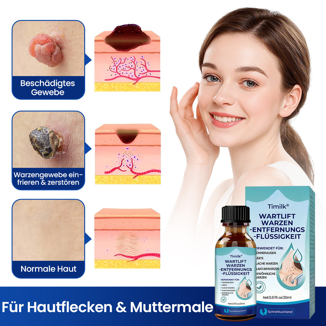 Timilk® WartLift Warzen-Entfernungsflüssigkeit❤️‍🔥