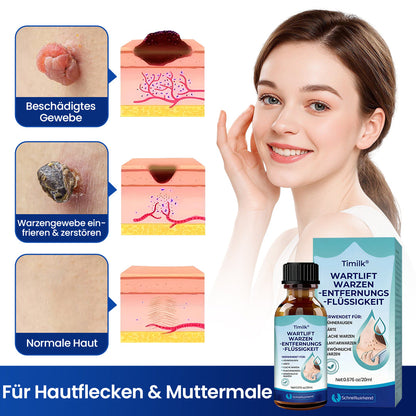 Timilk® WartLift Warzen-Entfernungsflüssigkeit❤️‍🔥