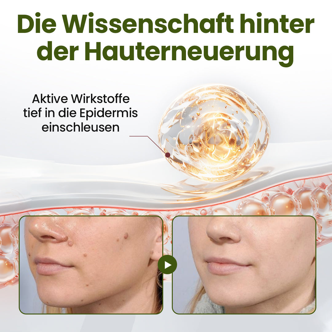 Biancat® MagneErase Erneuerungscreme