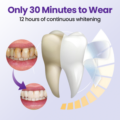 Biancat® 5D Zahnaufhellungsstreifen